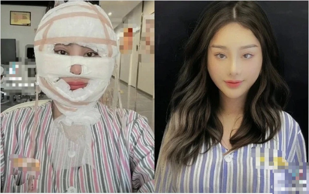 Lâm Khánh Chi nổi đóa đáp trả anti fans khi bị chê sau dao kéo, chẳng khác nào Trang Nemo - Hình 1