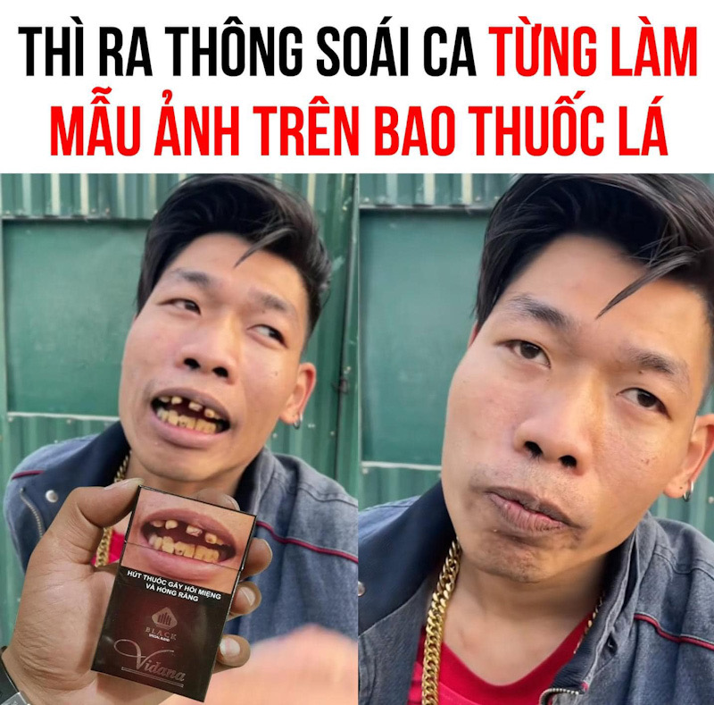 The handsome guy returned to social media with white porcelain teeth, now he cant close his mouth when he smiles, what are he planning? - Photo 3