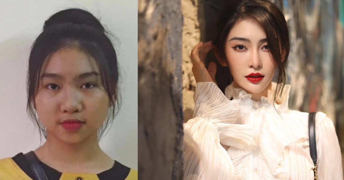 Linh Truong revealed an unsuccessful photo of puberty, the question of fixing her face made many people not recognize - Photo 7