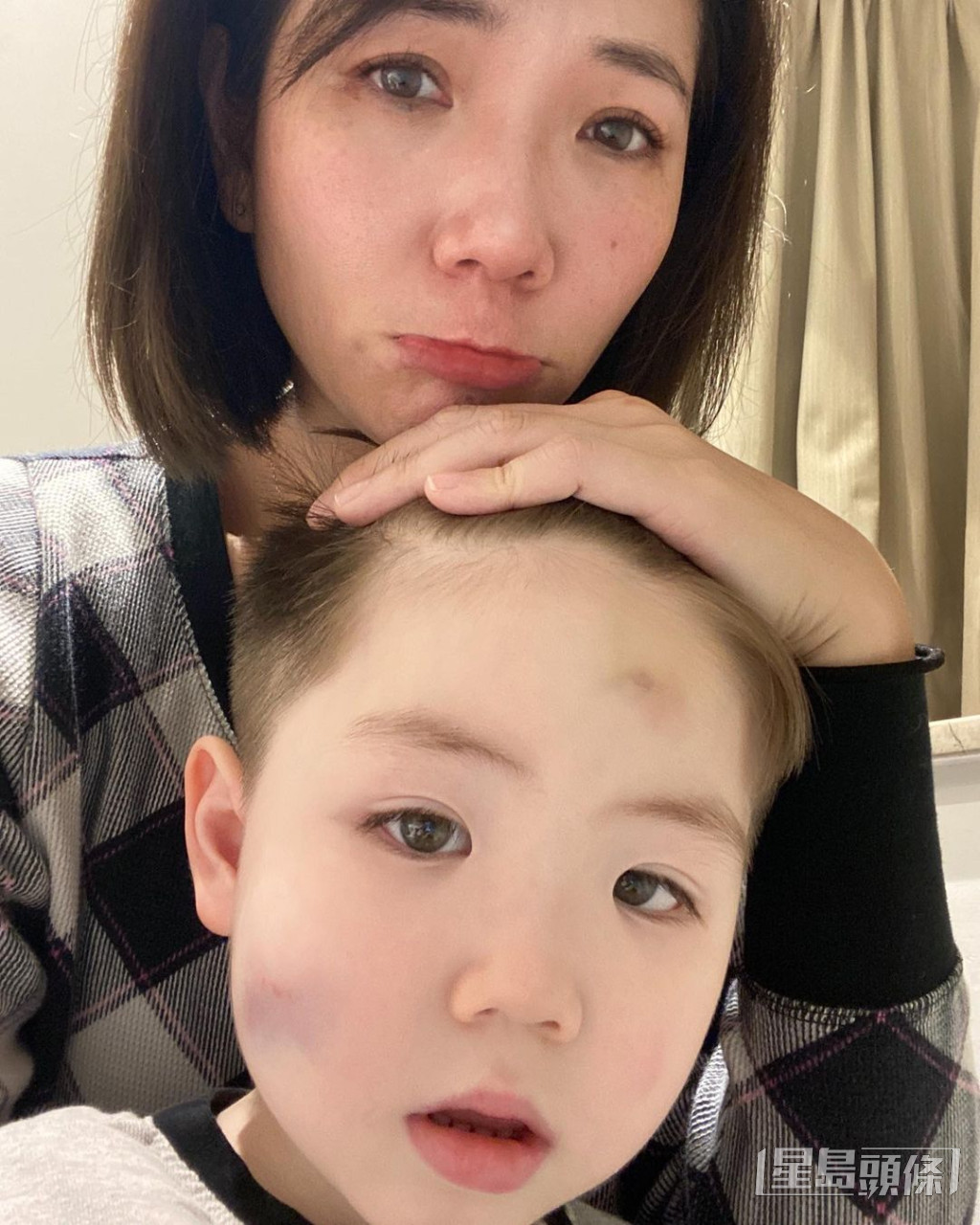 Tình cũ Trần Tiểu Xuân - Xa Uyển Uyển bị chồng tác động vật lý phải băng bó khắp người - Hình 4