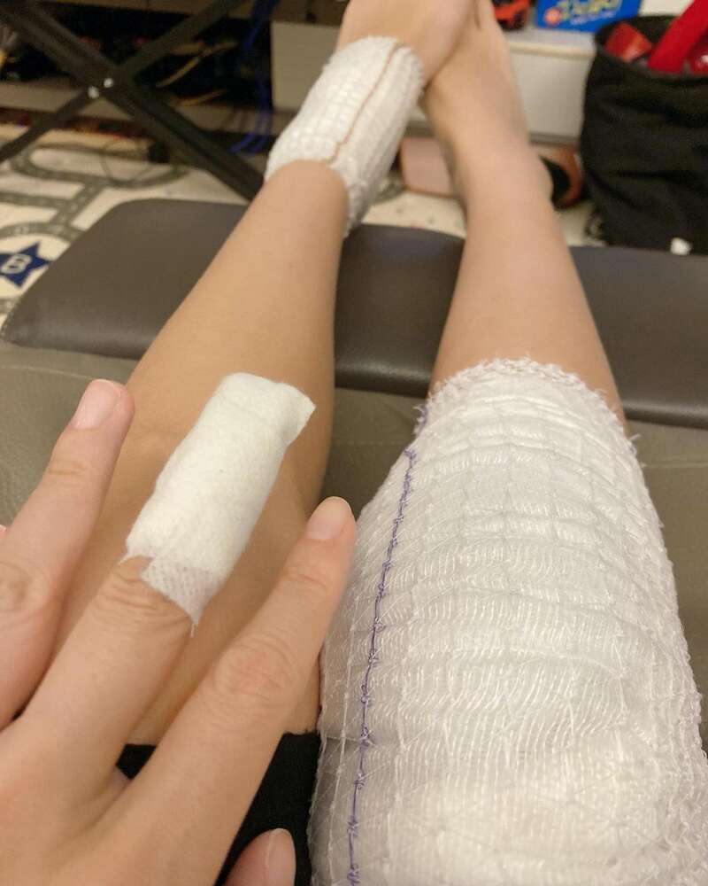 Tình cũ Trần Tiểu Xuân - Xa Uyển Uyển bị chồng tác động vật lý phải băng bó khắp người - Hình 3