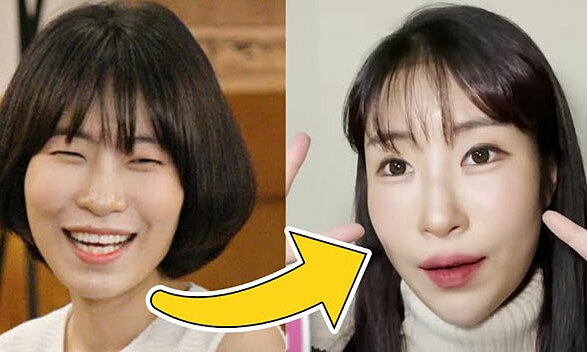 Từ Park Bom đến Hong Soo Ah: Những ngôi sao bị hủy hoại vì phẫu thuật thẩm mỹ - Hình 5