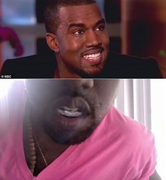 Kanye West pulled out all his real teeth, replaced them with new ones for 20 billion, and was immediately exposed for debt - Picture 3