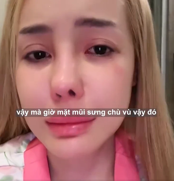 Ngân 98 bất ngờ cầu cứu CĐM, mũi nghi lộ biến chứng, tiền tỷ khó cứu? - Hình 2