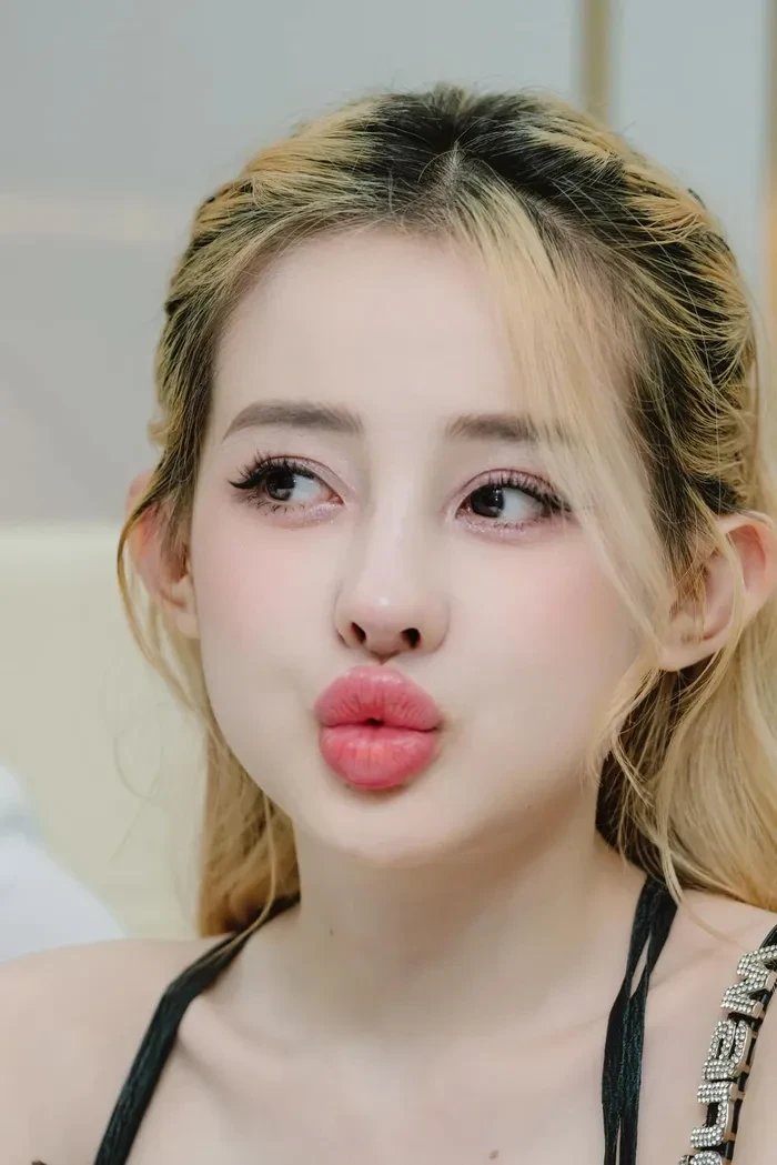 Ngân 98 bất ngờ cầu cứu CĐM, mũi nghi lộ biến chứng, tiền tỷ khó cứu? - Hình 5