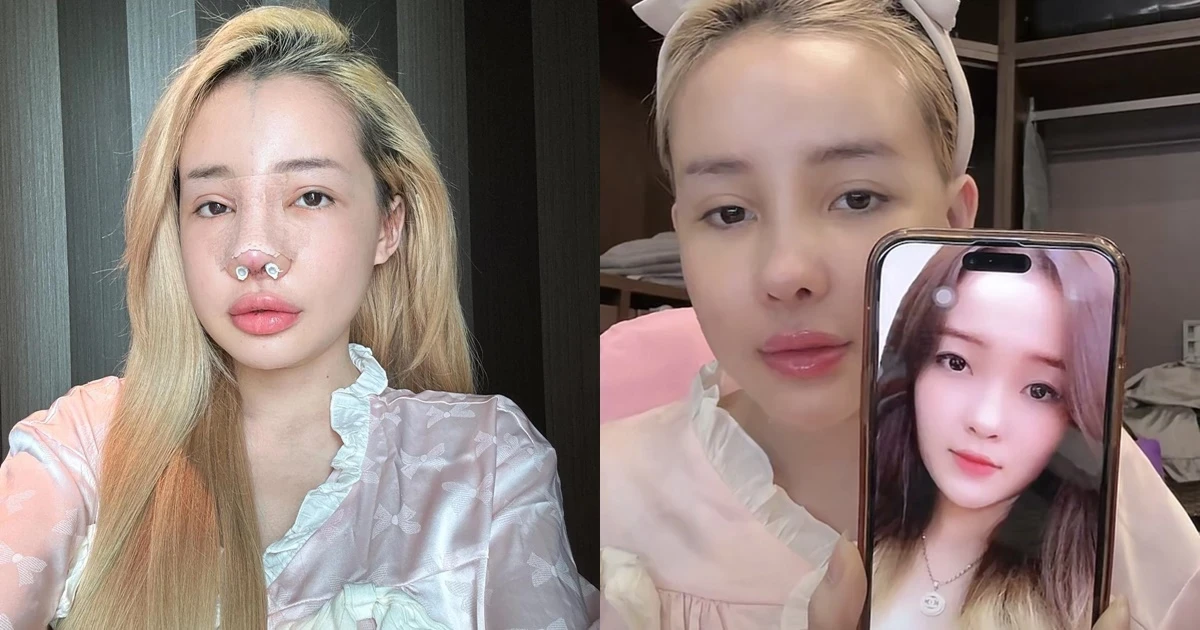 Ngân 98 bất ngờ cầu cứu CĐM, mũi nghi lộ biến chứng, tiền tỷ khó cứu? - Hình 4