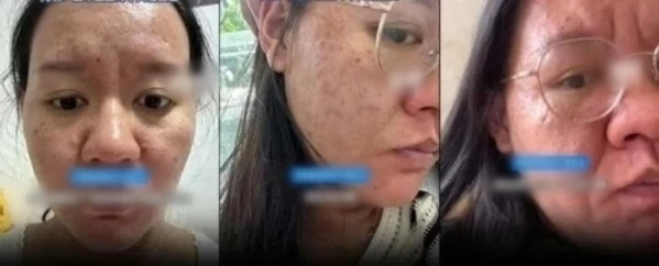 Cô gái cãi lời bác sĩ khi mang thai, đăng ảnh trước và sau khiến CĐM sửng sốt - Hình 6