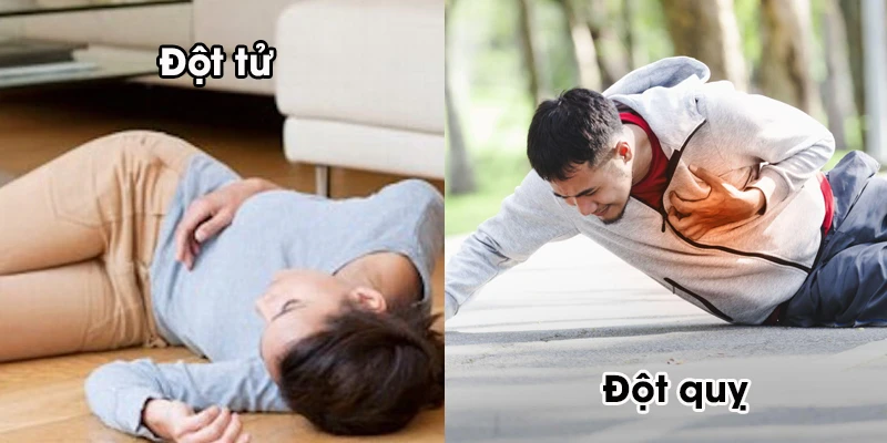 Từ vụ ông Hoàng Nam Tiến qua đời: đừng nhầm lẫn giữa đột tử với đột quỵ - Hình 3