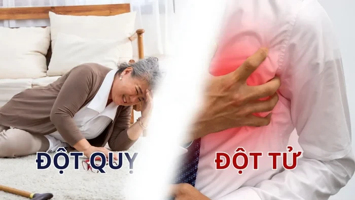Từ vụ ông Hoàng Nam Tiến qua đời: đừng nhầm lẫn giữa đột tử với đột quỵ - Hình 4