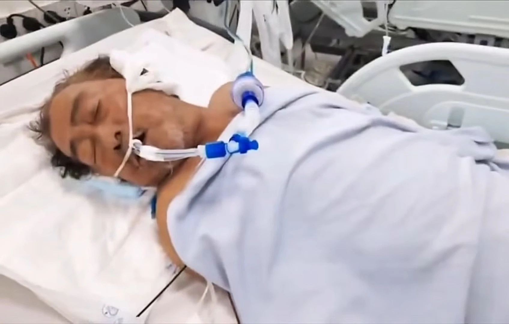 70-year-old Vu Linh Vuong was in a deep coma, the caregiver was stuck asking for help because he ran out of money - Photo 1